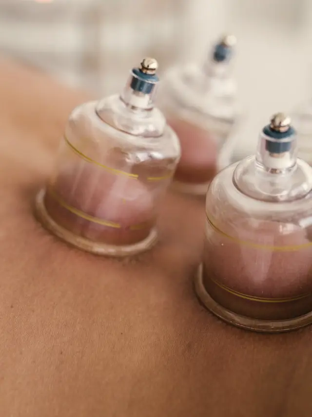 Glass cups placed along a patient's back during a cupping session